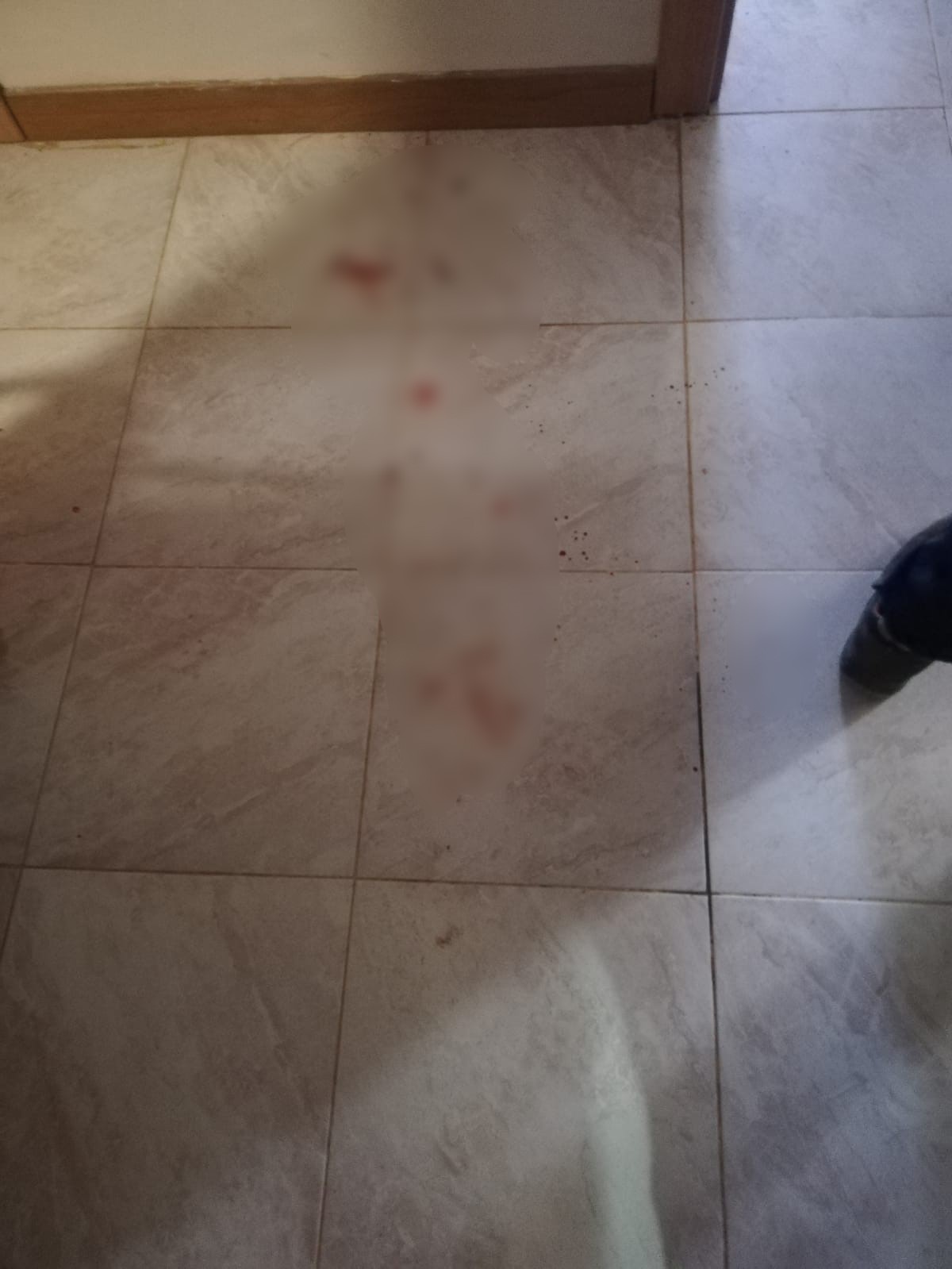 Gaziantep’te site yöneticisi kadına bıçaklı saldırı

