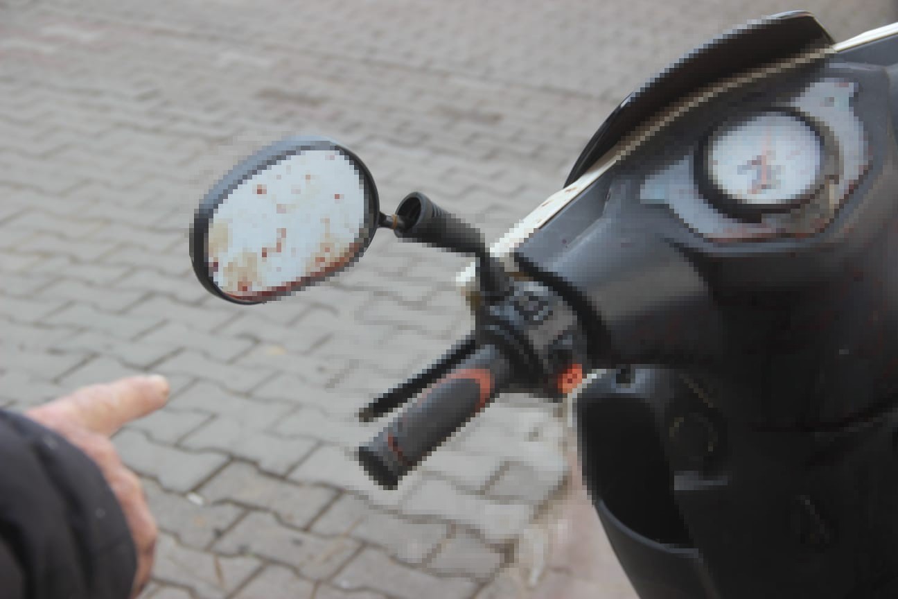 Sarkan kablo motosiklet sürücüsünün boğazını kesti, ölümden döndü
